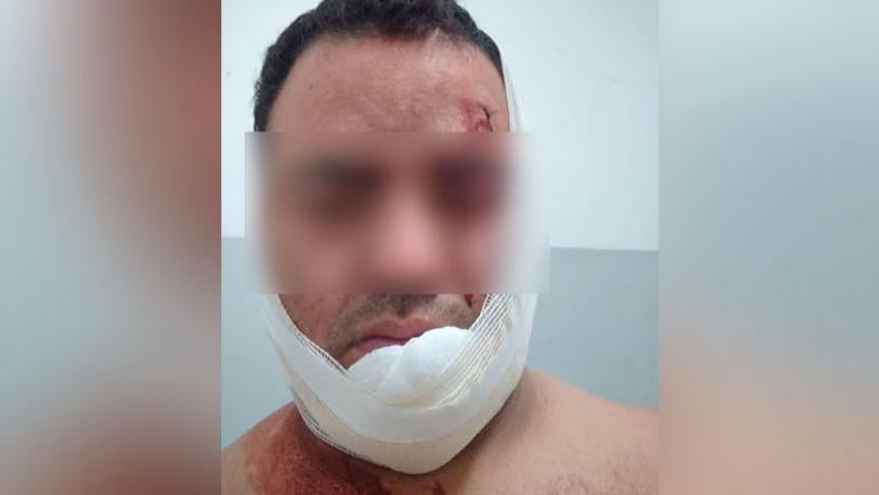 Brutal ataque a un taxista en Córdoba: intentaron degollarlo para robarle