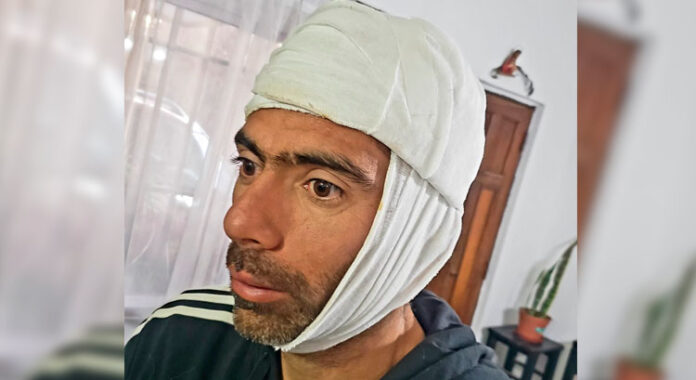 Una de las víctimas sufrió lesiones en su cabeza. (Leonardo Guevara)