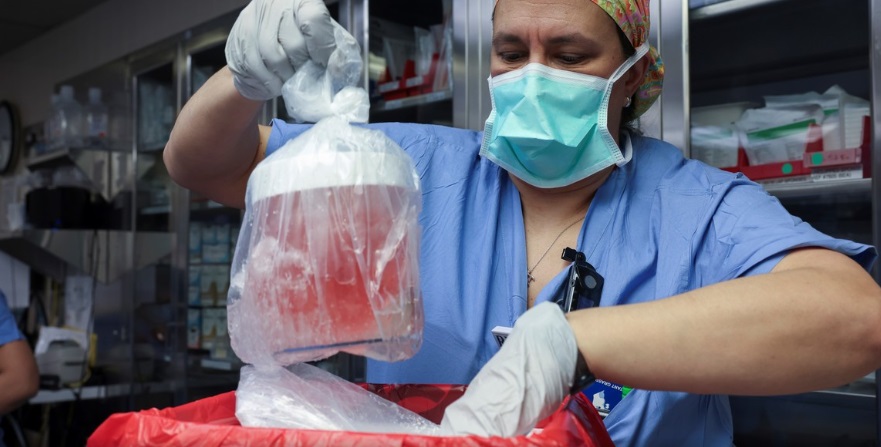 Falleció el hombre que recibió el primer trasplante de riñón de cerdo genéticamente modificado