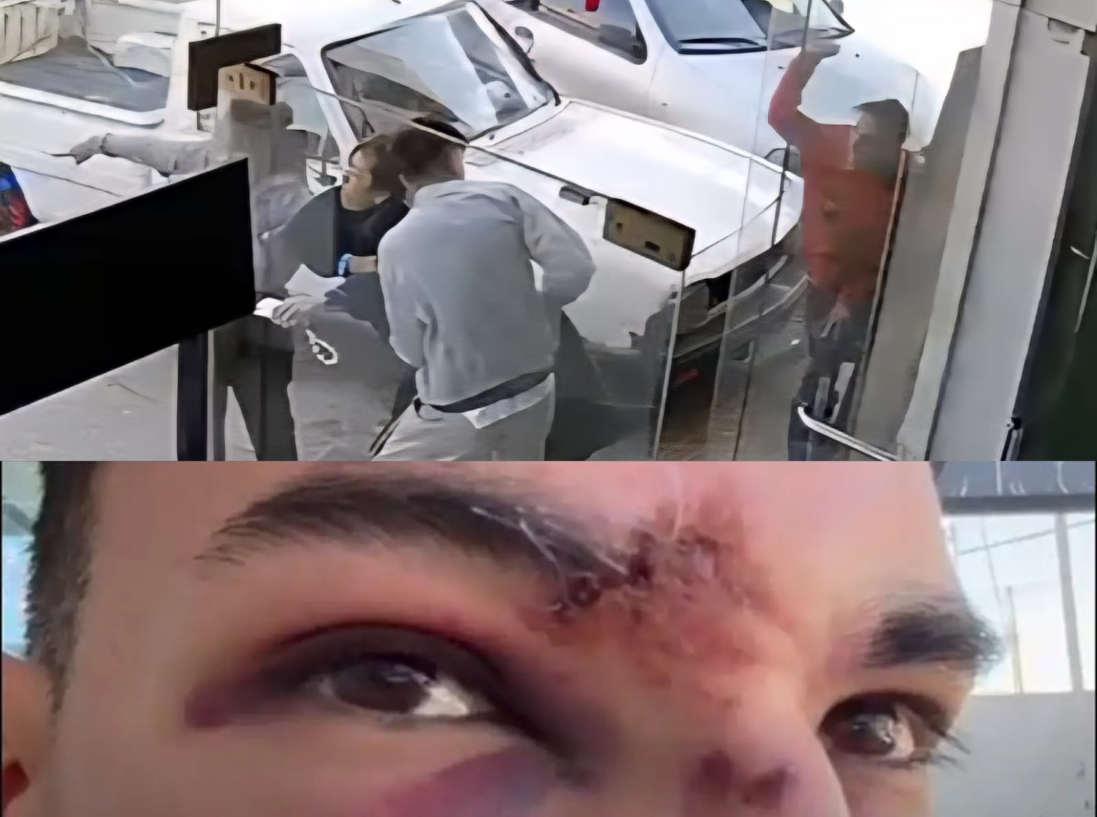 Relatos salvajes en Carlos Paz: le desfiguraron la cara a golpes tras un accidente de tránsito (videos)