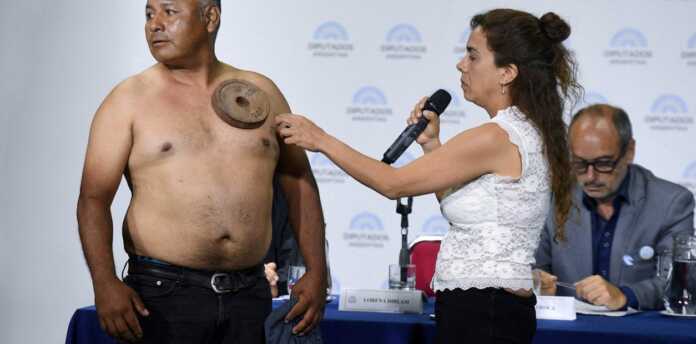 y78BKbitq_1256x620__1