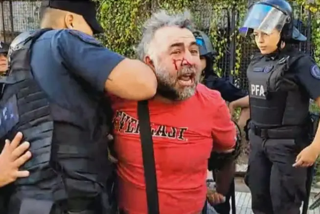 camarógrafo agredido en el Congreso mientras trabajaba