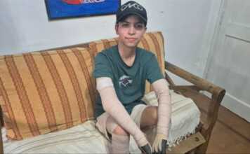 Le explotó el celular, sufrió graves quemaduras y permaneció 2 meses internado