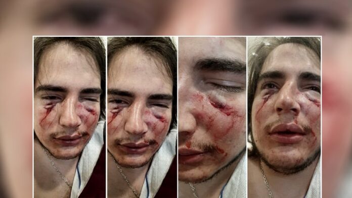 5fd0a60659c8b_1004x565