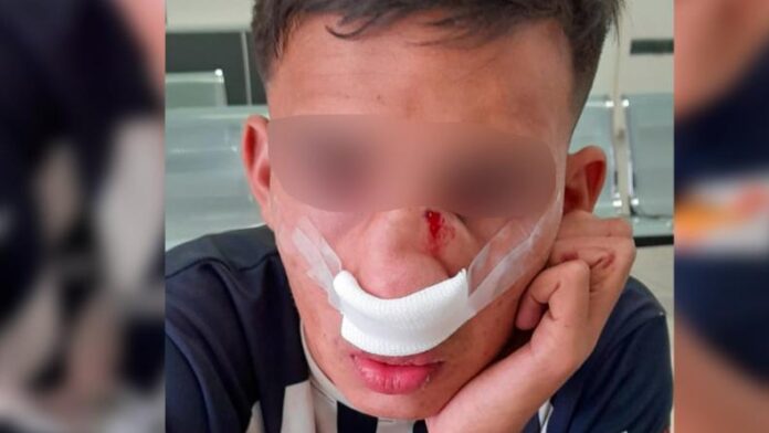 agredido en La Calera