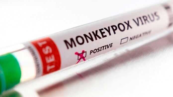 test viruela del mono