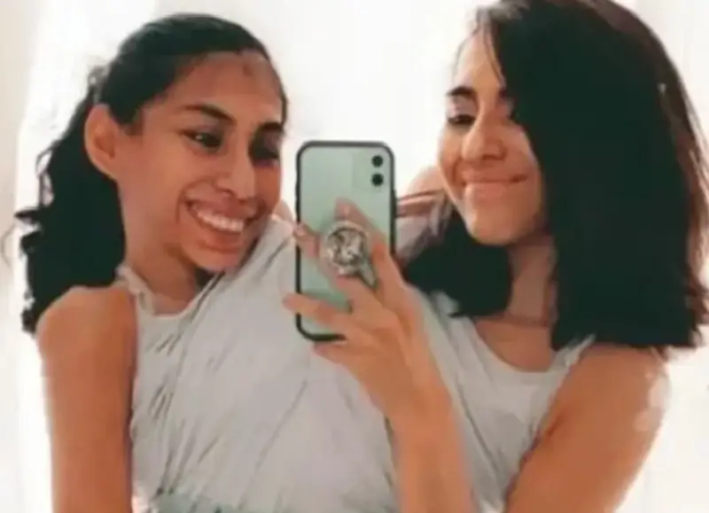 siamesas