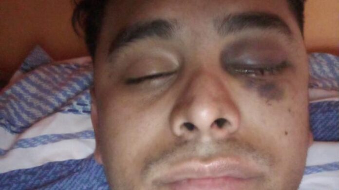 El inquilino fue atacado por el propietario de la vivienda