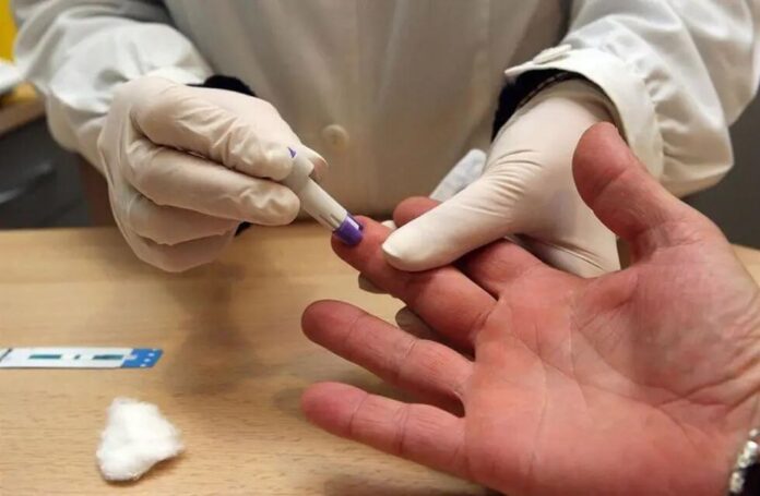 testeo HIV