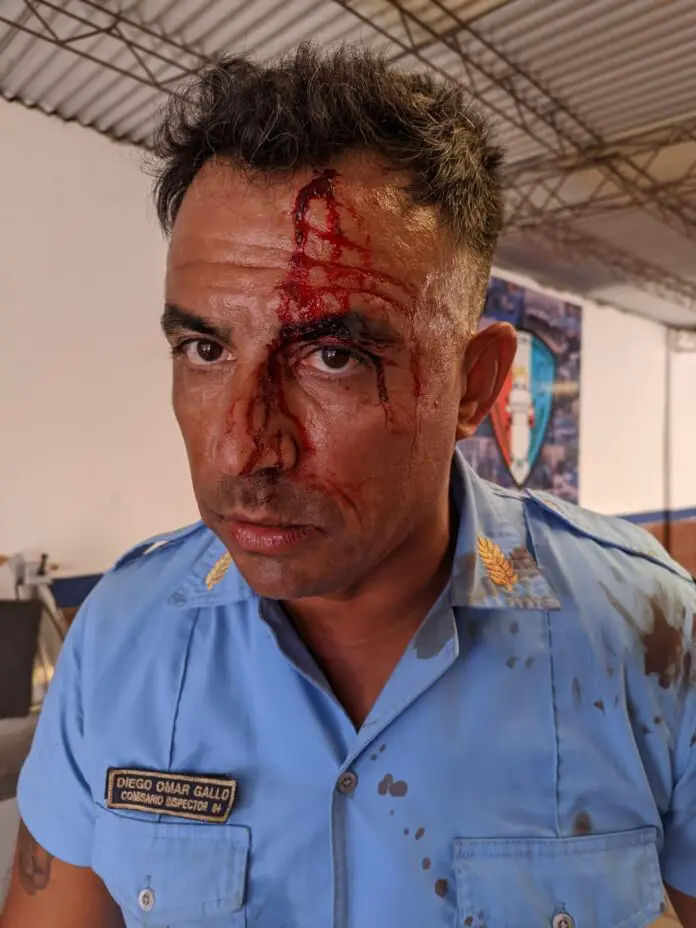 policía herido