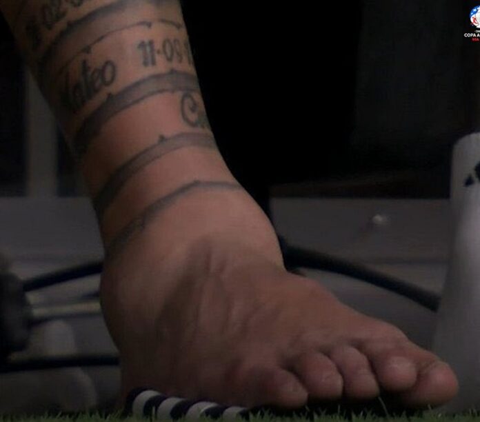 tobillo messi