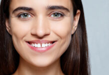Lo que debés saber sobre el diastema