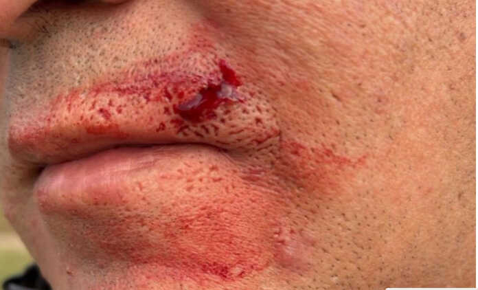 golpearon a un policia