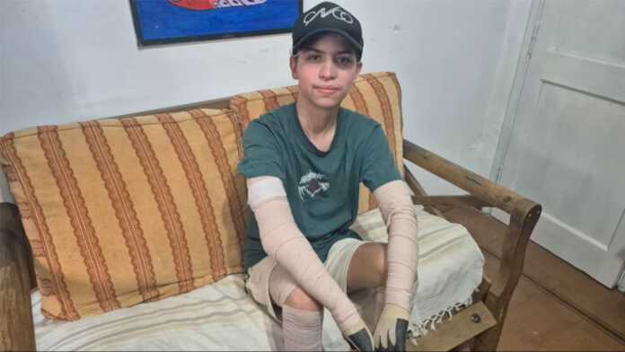 benjamin-se-recupera-del-accidente-domestico-que-le-cambio-la-vida-M77UO7EMSFA2FFOGWUOJZCWWAA