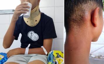 Violencia escolar: un alumno con epilepsia fue brutalmente golpeado en Córdoba